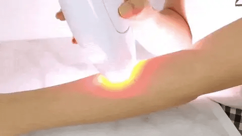 Depiladora Láser IPL – Eliminación de Vello Indolora para Rostro y Cuerpo