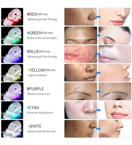 Máscara LED Facial 7 Colores – Terapia de Luz Antienvejecimiento y Anti-Acné